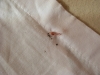 Hotel Bedbugs Inspection Photo 4